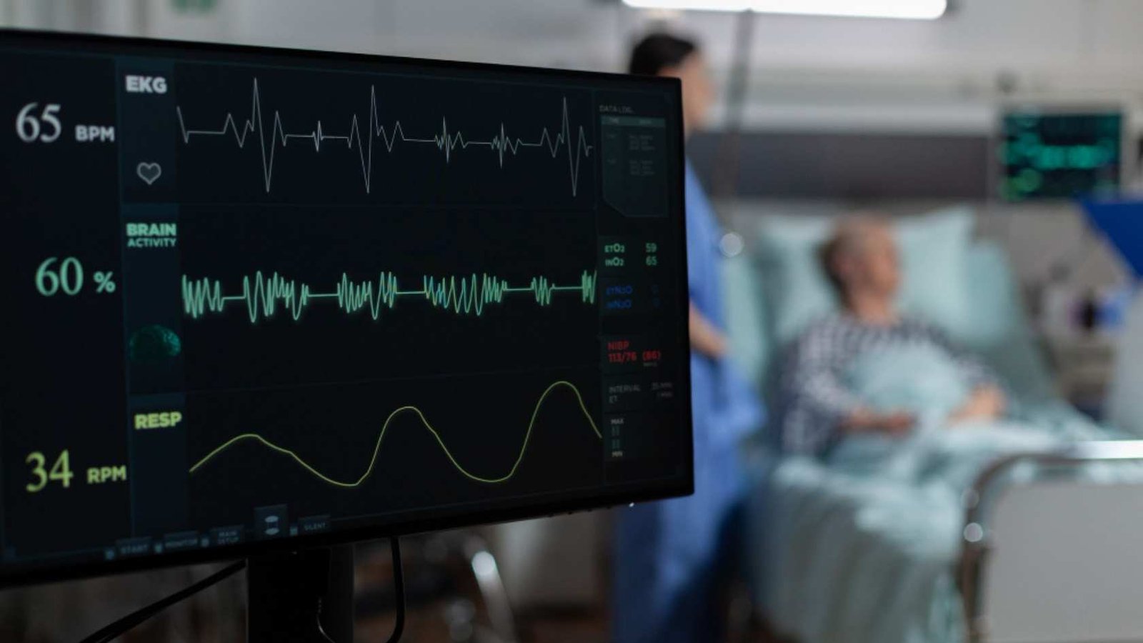 Electrocardiogram (ECG)